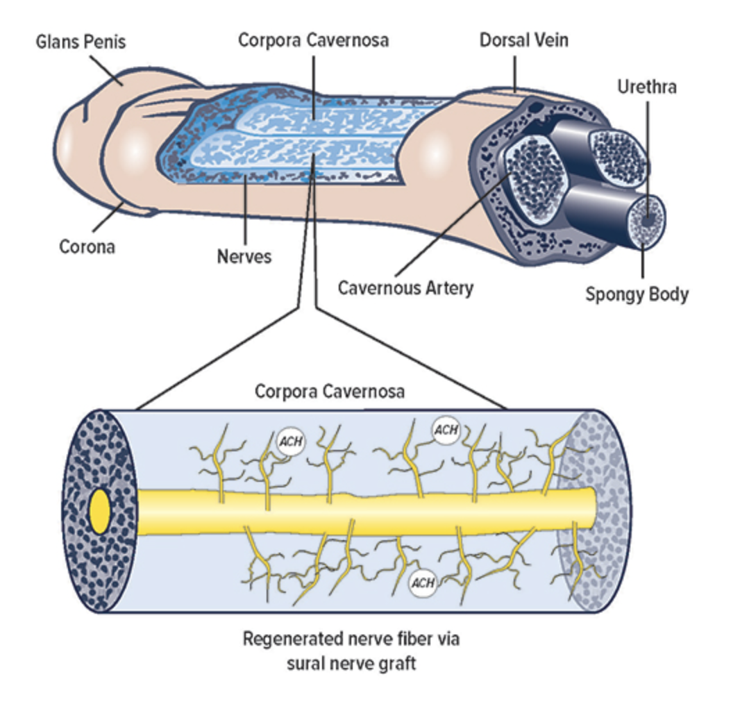 Penile nerve reconstruction surgical diagram